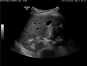 abd-sm02-start-image.jpg