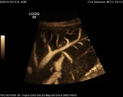 c1-6-fnh-bf01-start-image.jpg