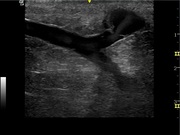 vascular-lower-ext-1.jpg