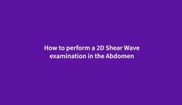 How to perform a Shear Wave examination in the Abdomen