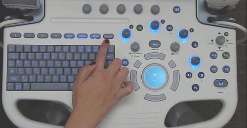 LOGIQ S7 - Control panel overview