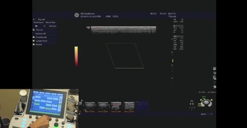LOGIQ P9/P7- Power Doppler controls